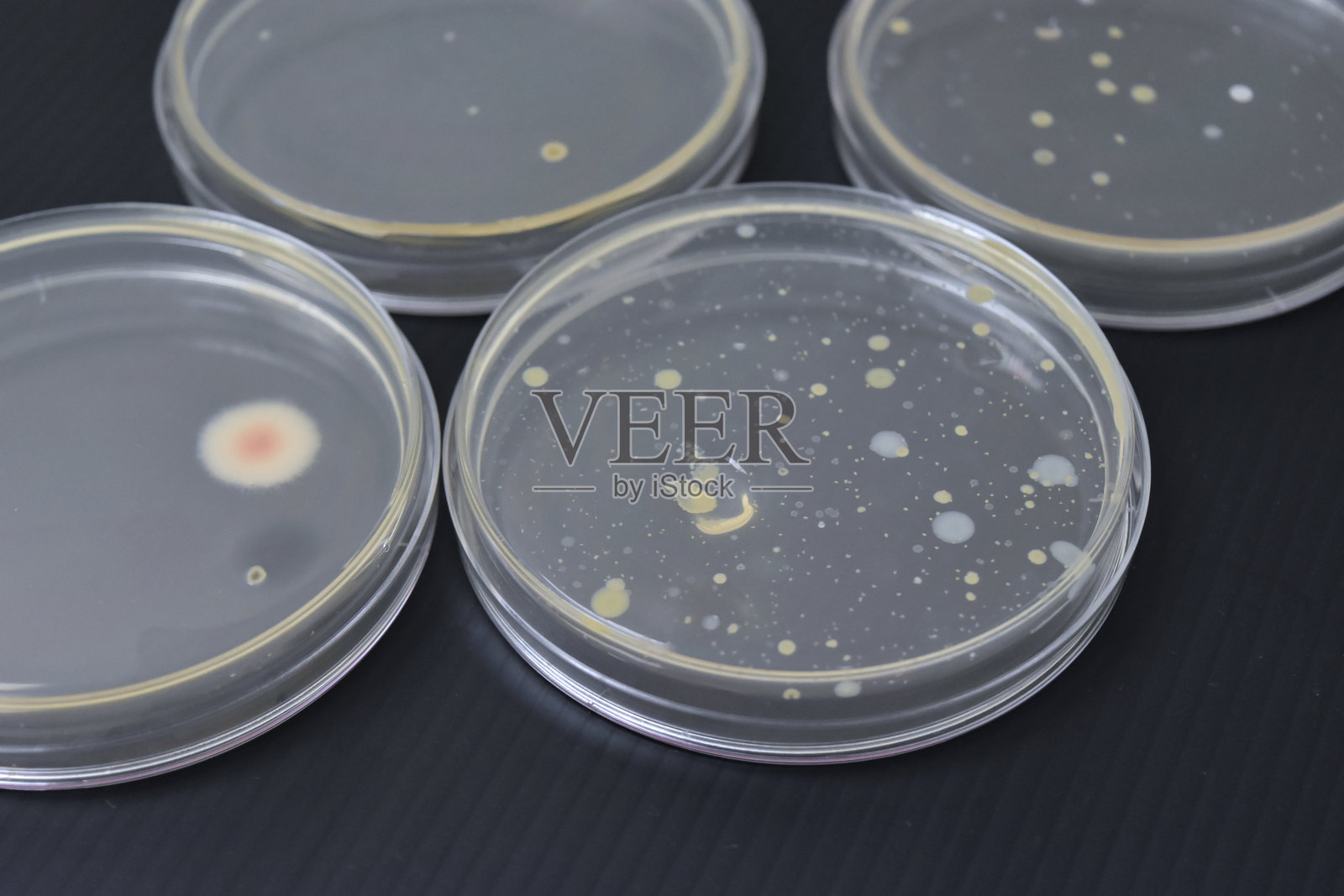 琼脂平板上细菌菌落的生长照片摄影图片