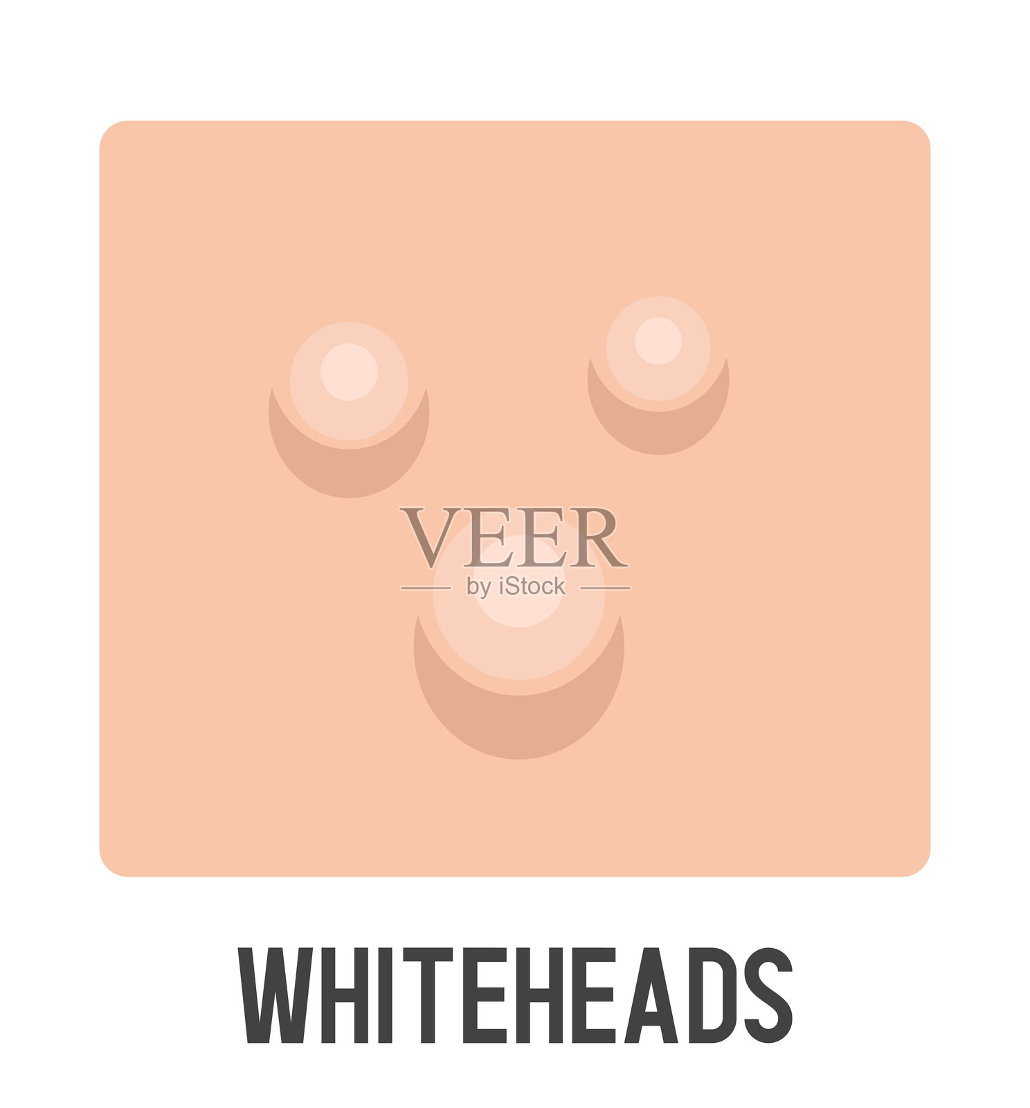 闭合性粉刺矢量图。白头粉刺。痤疮类型。矢量扁平剪贴画插画图片素材