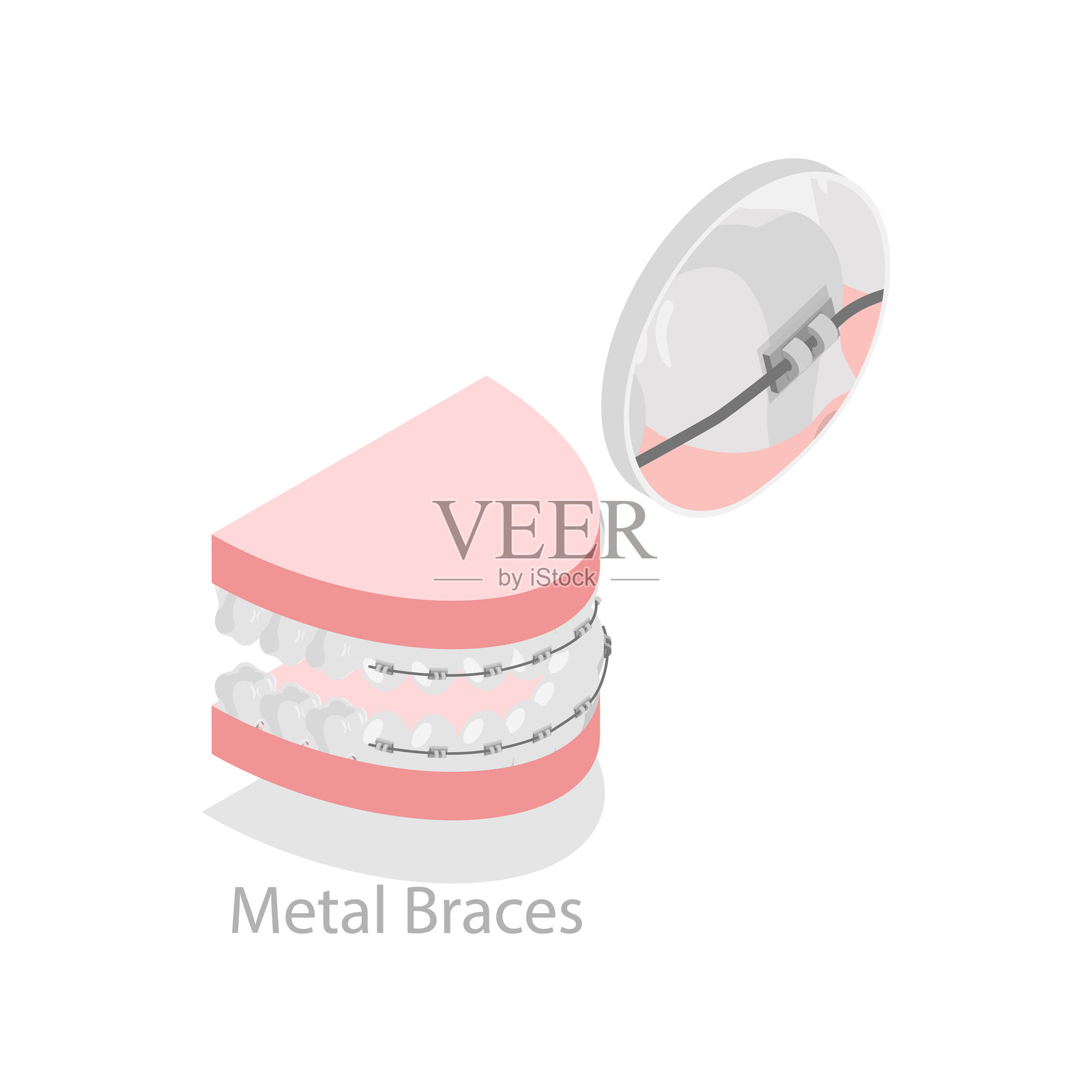 牙齿矫正器类型3D等距平面矢量图。项目6插画图片素材