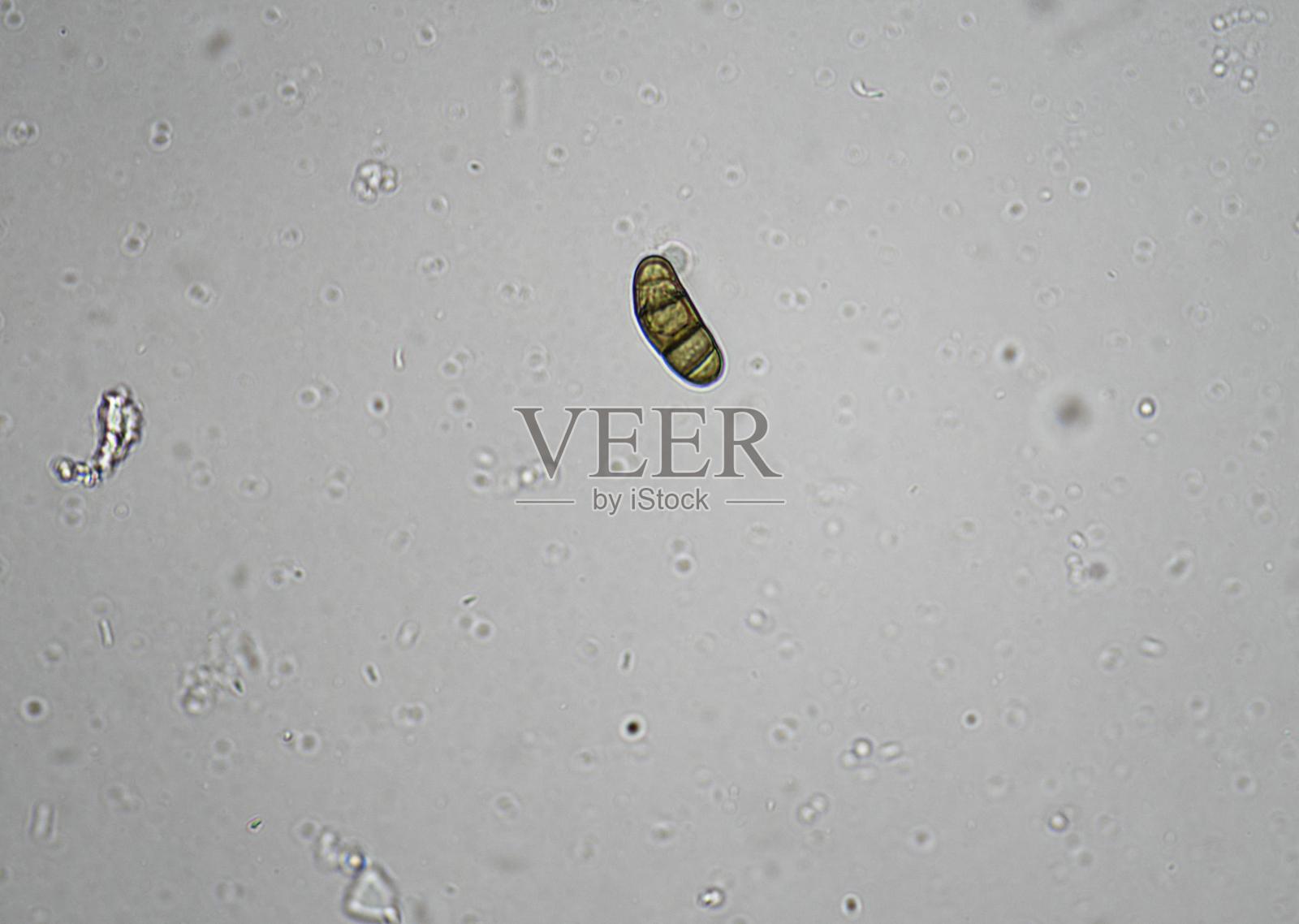 显微镜下的土壤微生物，包括变形虫、鞭毛虫、线虫、真菌和细菌照片摄影图片