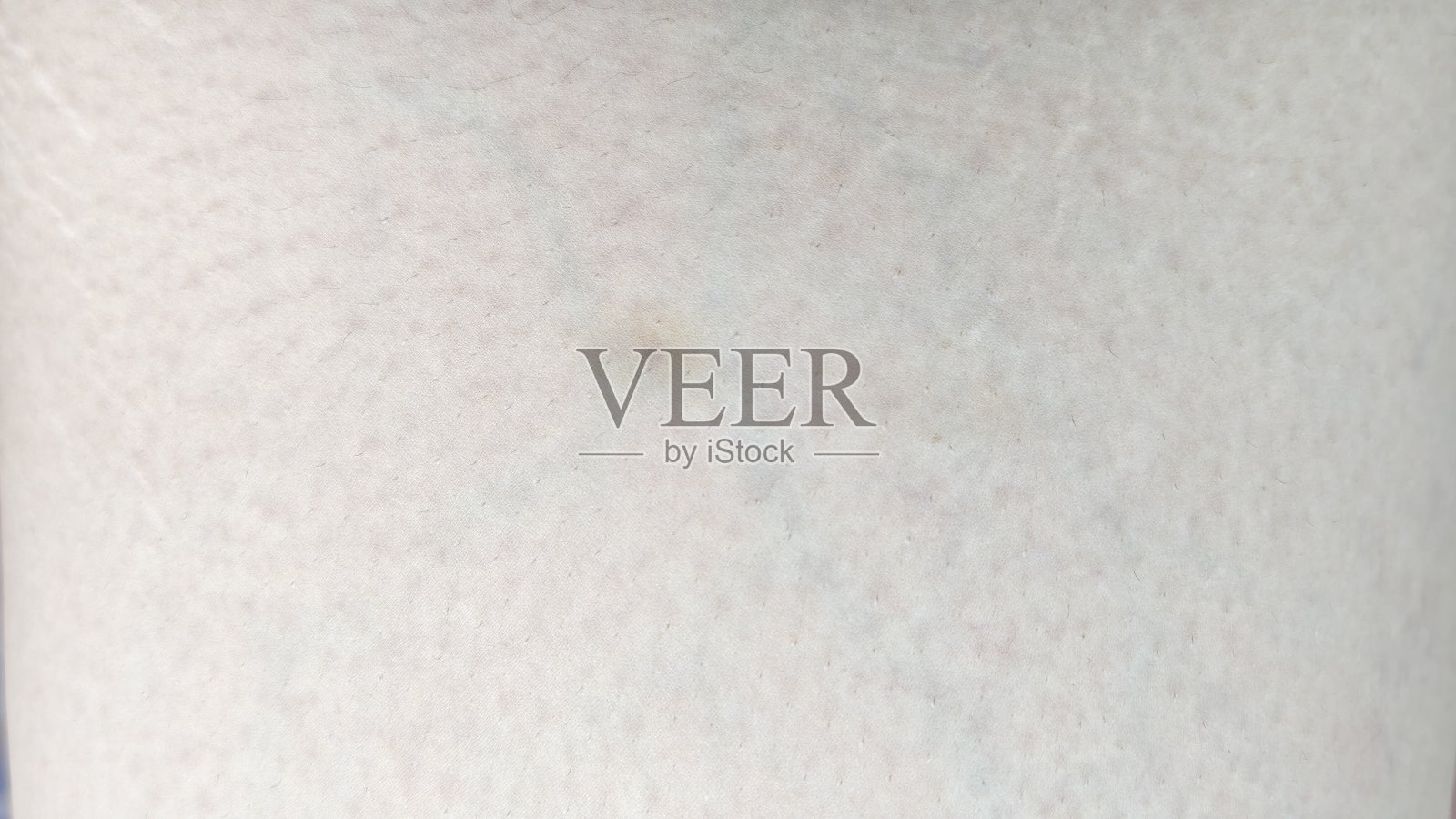 人体上的小瘀伤。照片摄影图片