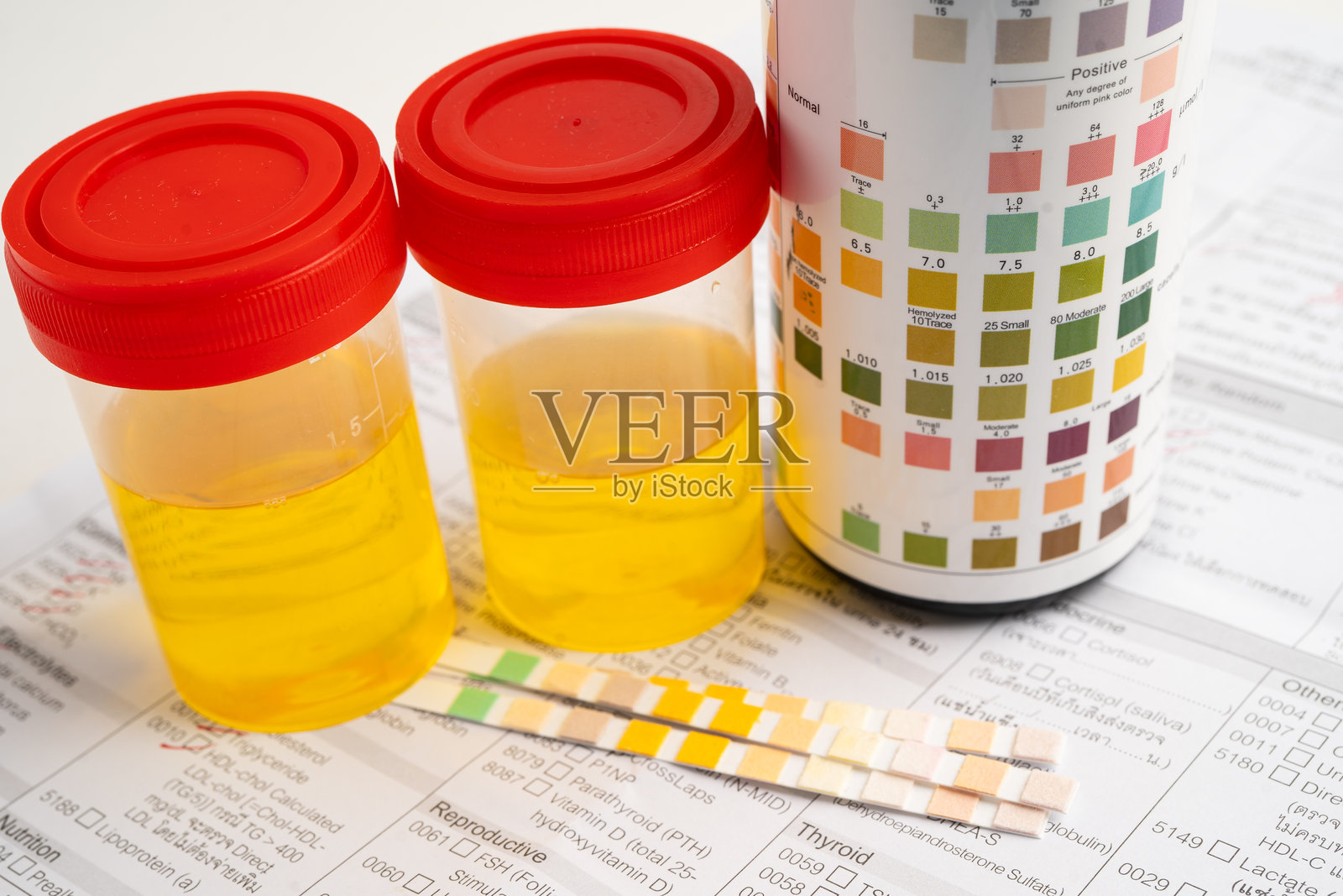 实验室里的尿液分析，尿杯，试纸pH试纸和比色卡。照片摄影图片