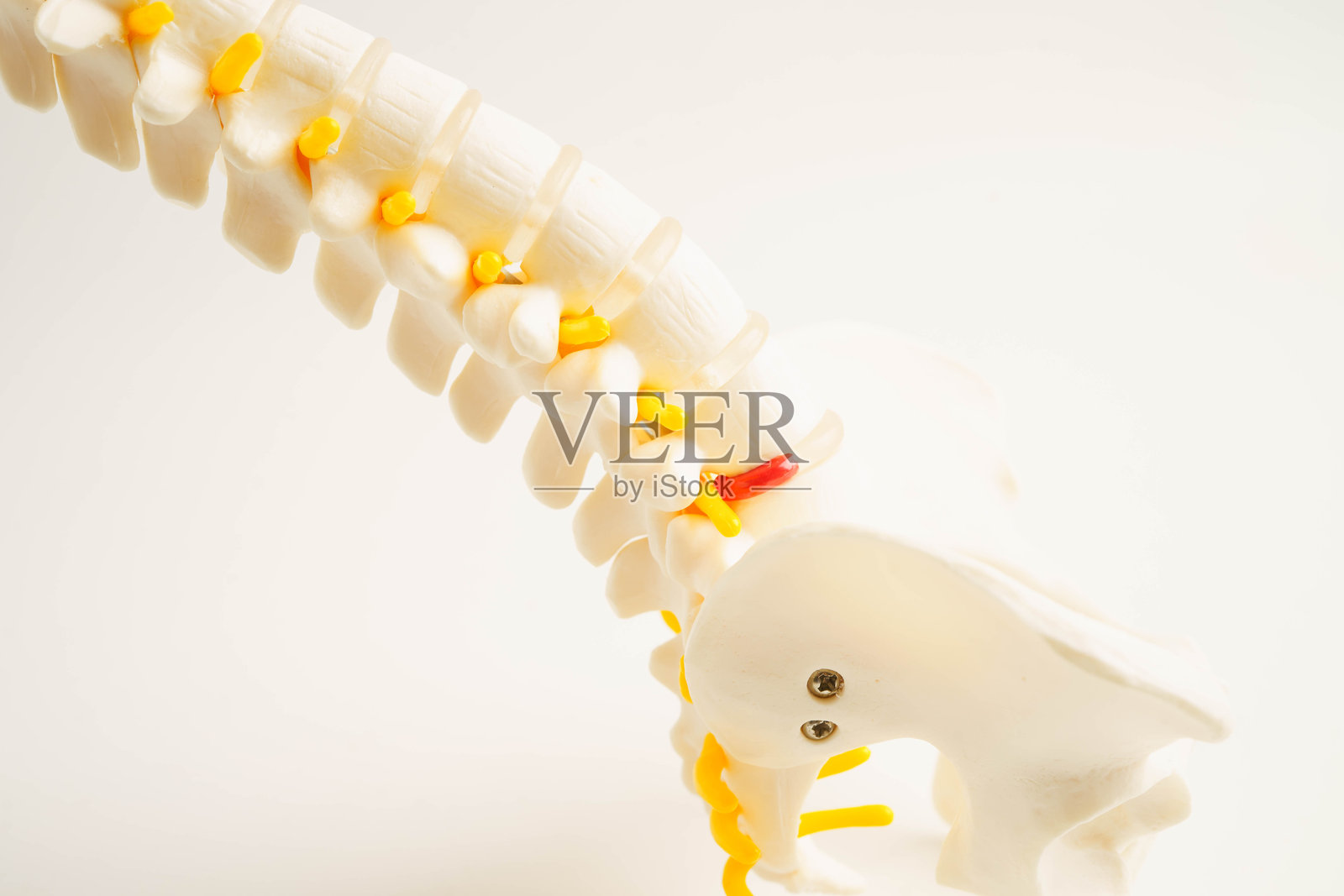 脊神经与骨骼，腰椎椎间盘突出碎片，骨科治疗模型。照片摄影图片