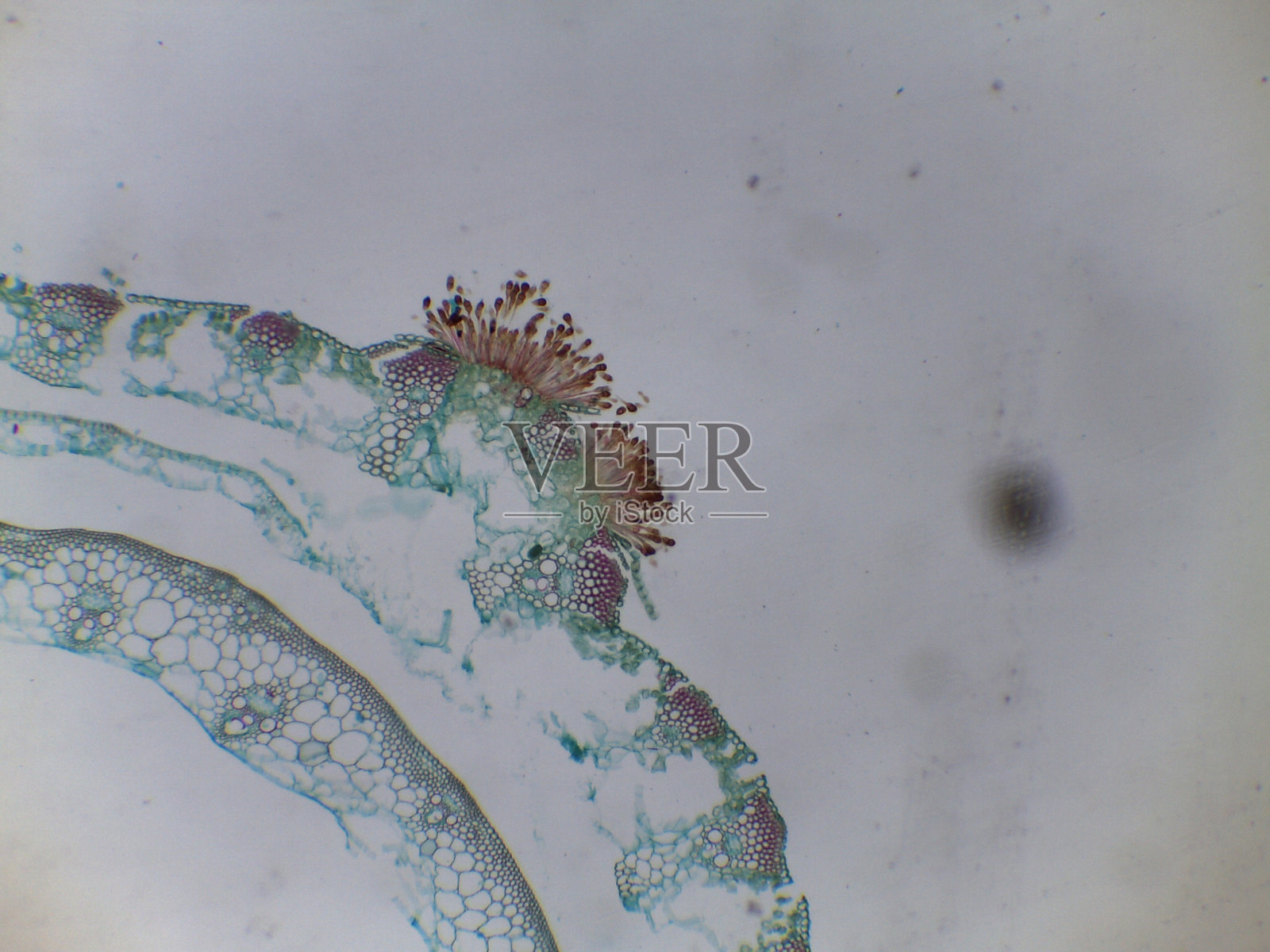 担子菌门锈菌生命周期：染色制剂显示成熟的二倍体冬孢子和担子柄，用于冬季生存照片摄影图片