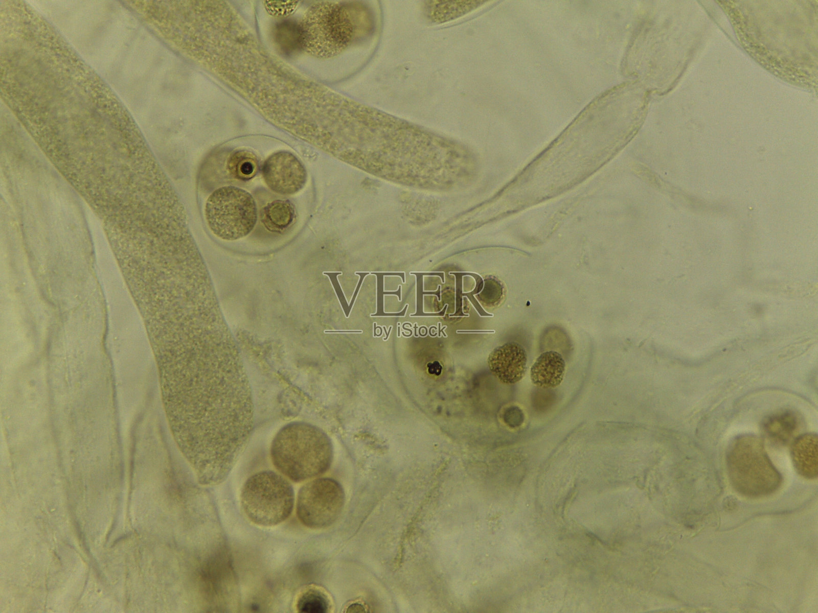 未染色水霉卵菌的性结构显微照片：充满发育中的卵孢子的卵囊照片摄影图片