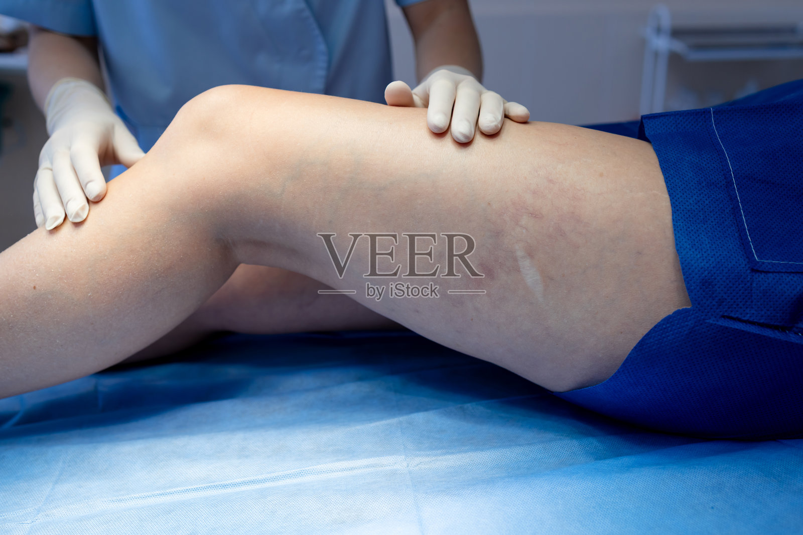 血管腿部检查。轻柔地触诊大腿以评估静脉模式。照片摄影图片