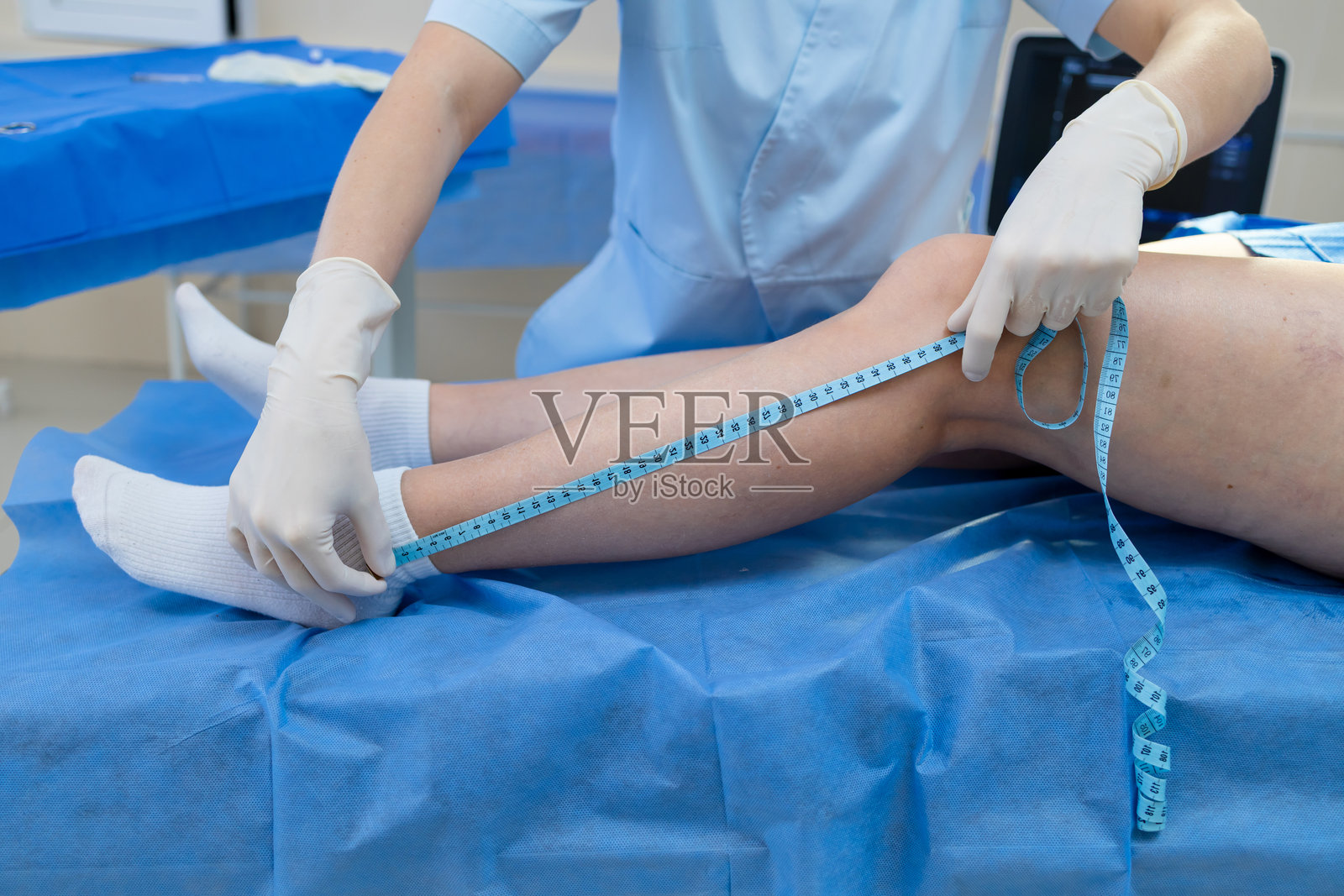 血管外科医生用卷尺测量腿部长度和周长照片摄影图片