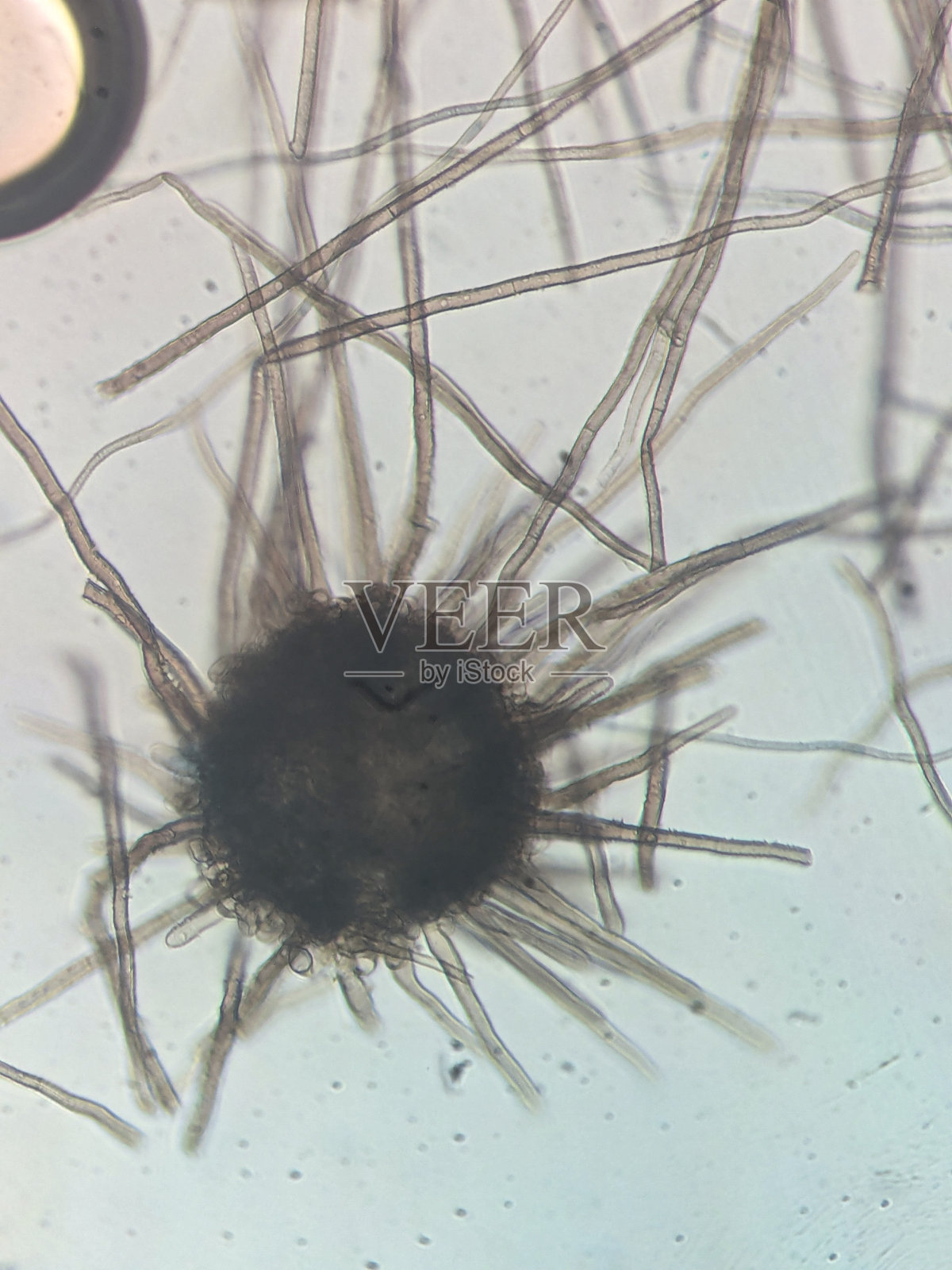 毛状菌丝的子囊菌（Chaetomium Fungi）的显微镜视图照片摄影图片