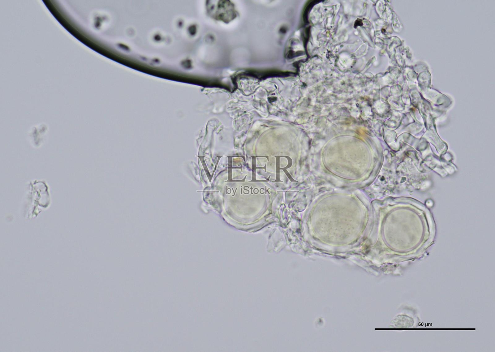 显微镜下的土壤微生物，包括变形虫、鞭毛虫、线虫、真菌和细菌照片摄影图片