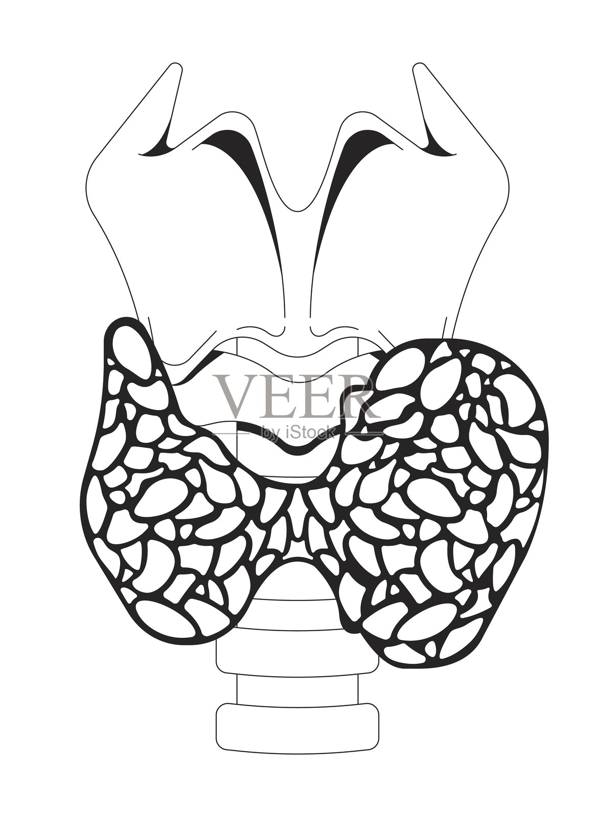 甲状腺功能亢进症导致甲状腺肿大示意图插画图片素材