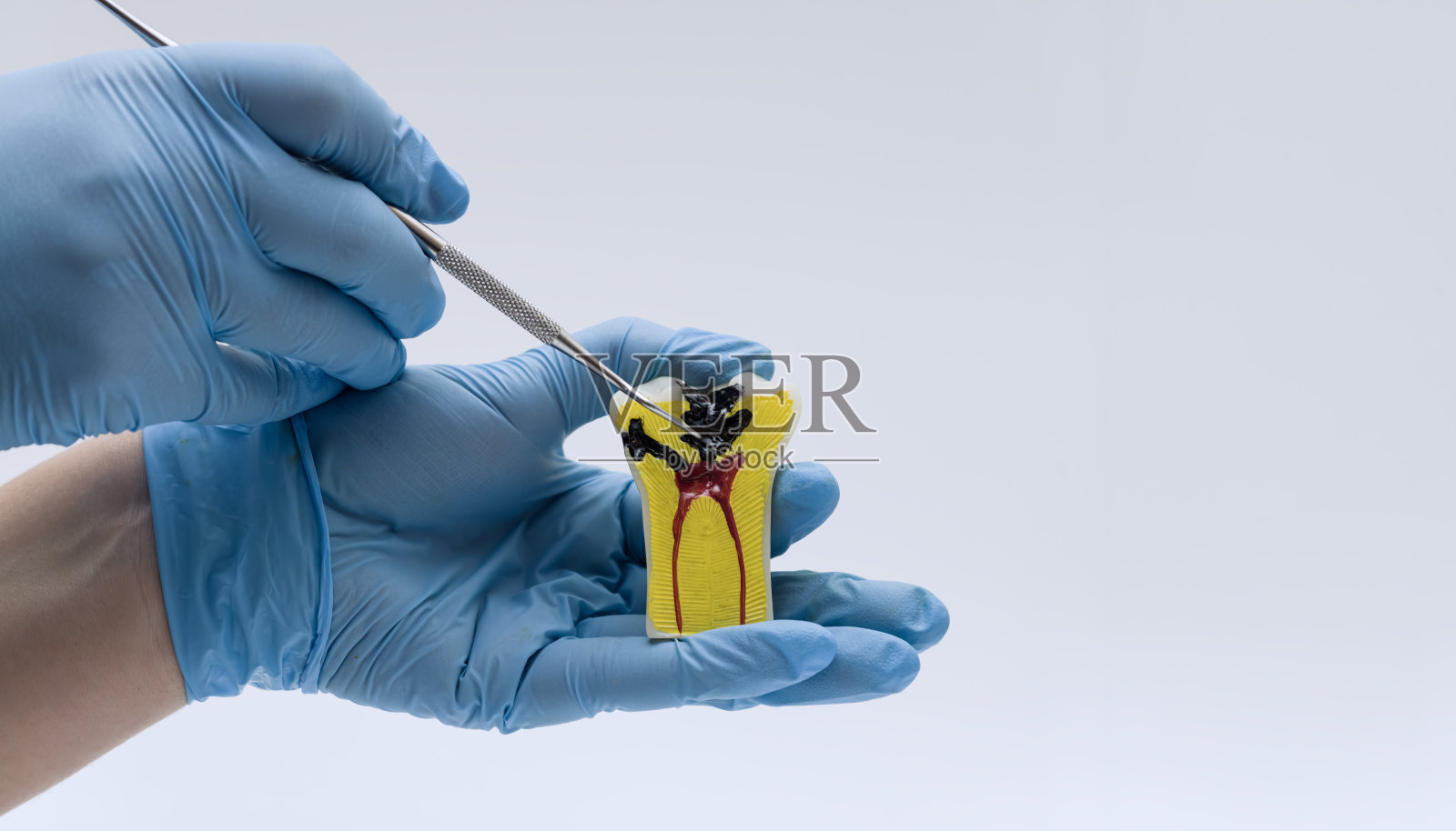 牙医用探针指向龋齿模型照片摄影图片