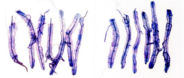 科学玻璃显微镜载玻片，植物组织内有真菌图片下载