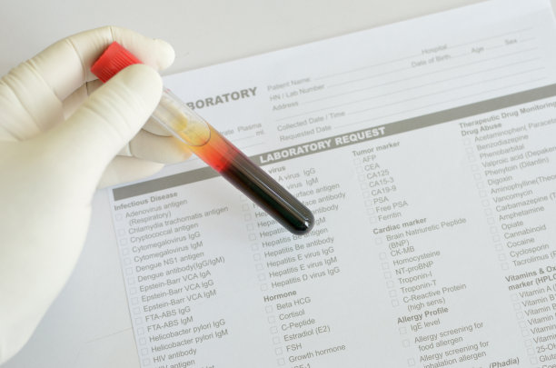 血液样本图片下载