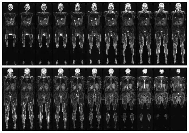扫描人体图片下载
