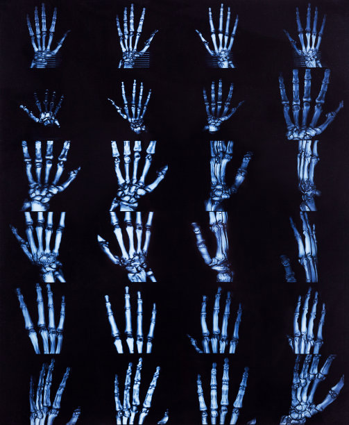 x射线的手图片下载