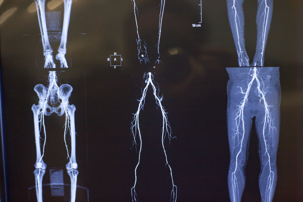 人体器官的x射线照片图片下载