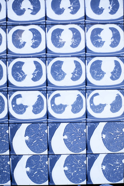 人体器官的x射线照片图片下载