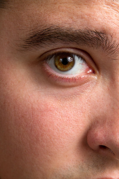 充血的眼睛图片下载