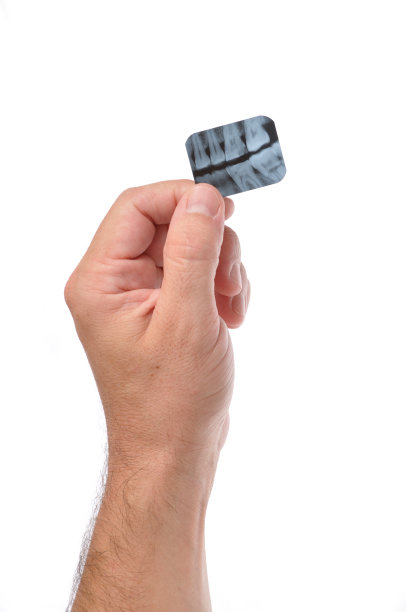 牙医手持x光隔离图片下载