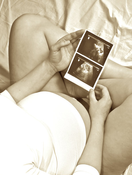 胎儿的超声画像图片下载