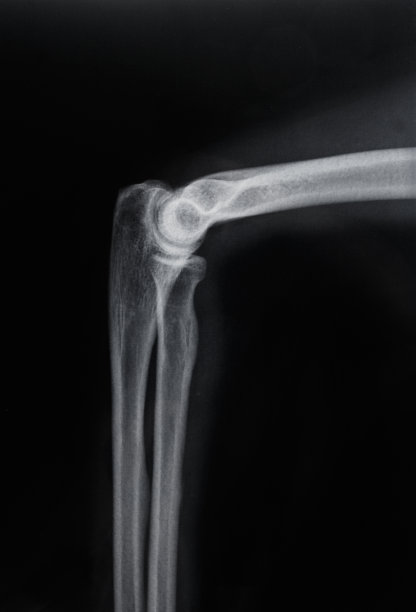 肘关节图片下载