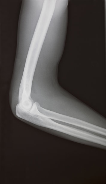 x射线图像图片下载