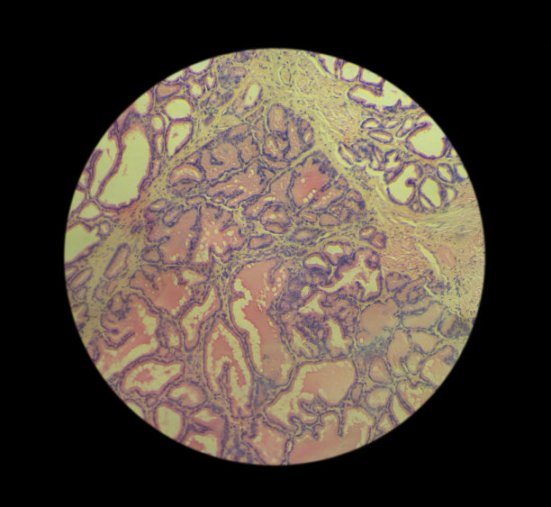 前列腺缩影照片图片下载