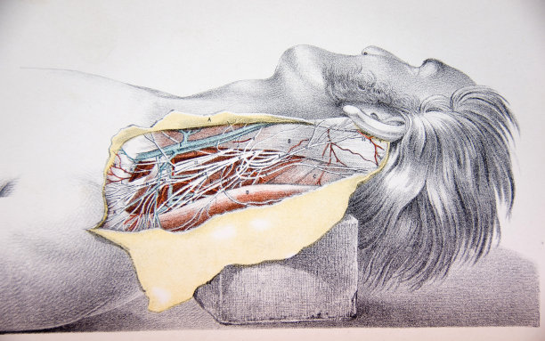解剖过程中人体颈部的石印插图图片下载