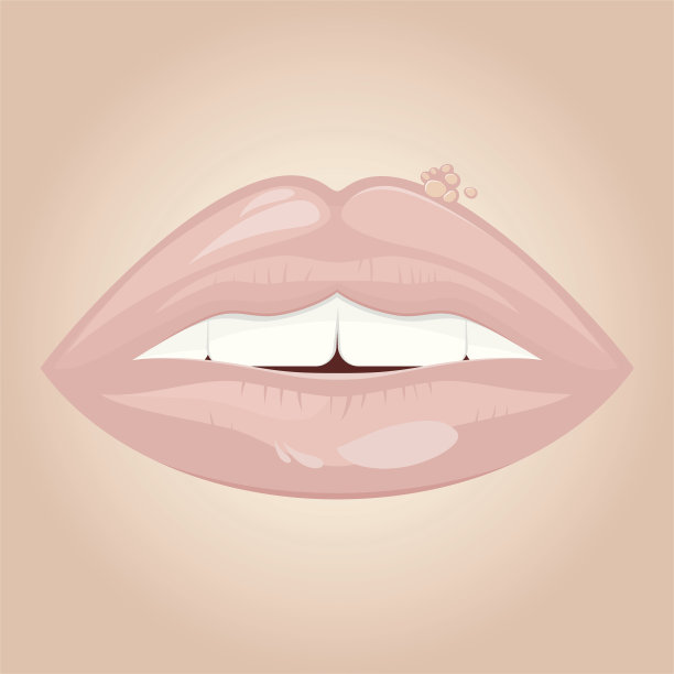 疱疹病毒感染图片下载