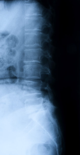 女性脊椎图片下载