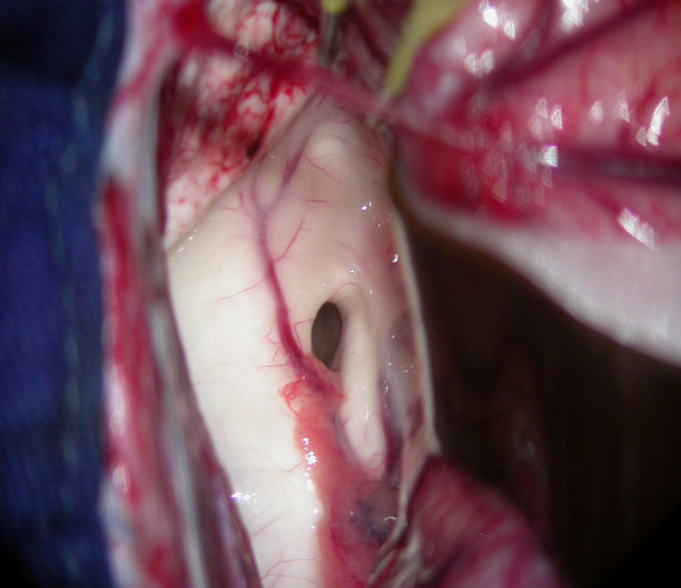 脑部手术图片下载