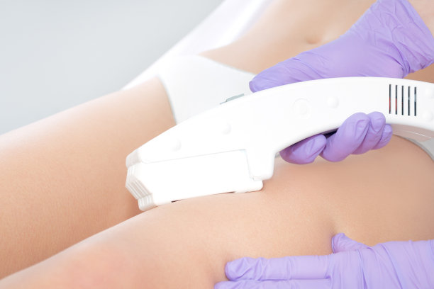 年轻女子接受激光脱毛治疗图片下载