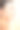 用艾灸针烫女人图片下载