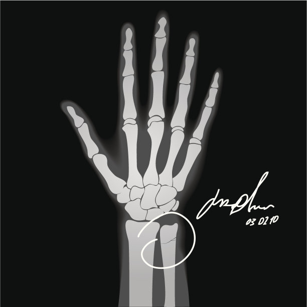 Brooken手图片下载