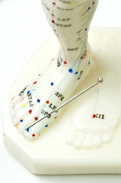 针灸示范图片下载