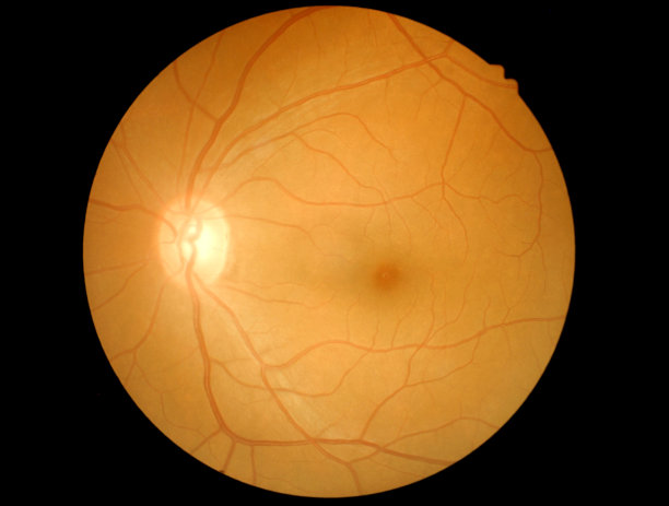 医学摄影视网膜图片下载