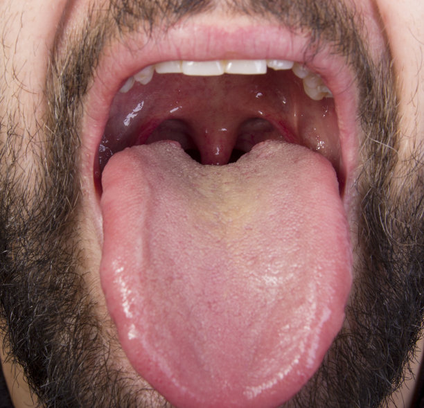 扁桃体图片下载