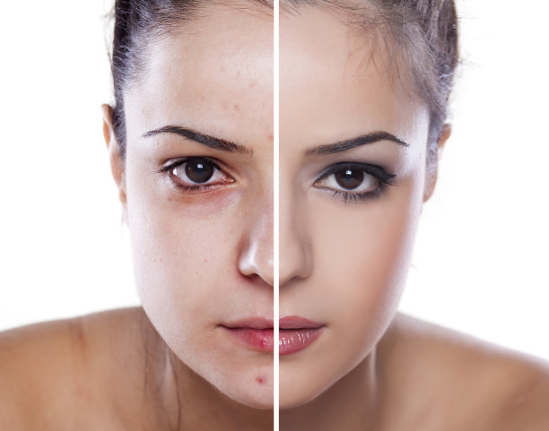 之前和之后图片下载