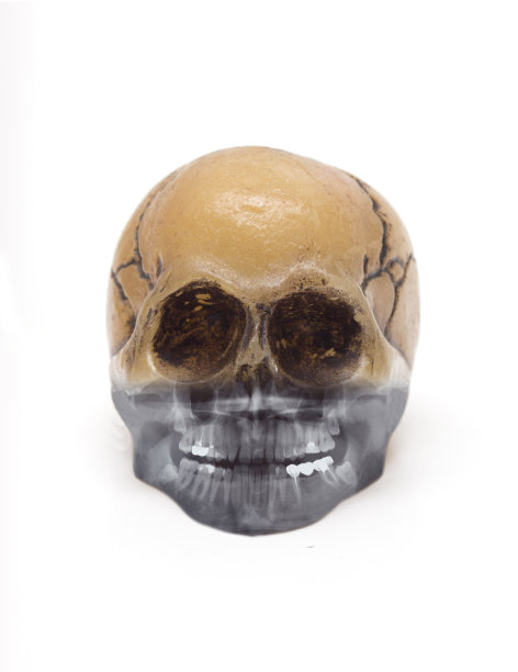 头骨和x射线图片下载