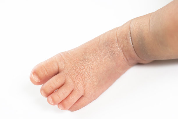 婴儿的脚趾图片下载