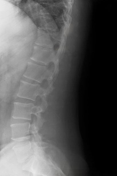 侧腰曲线图片下载