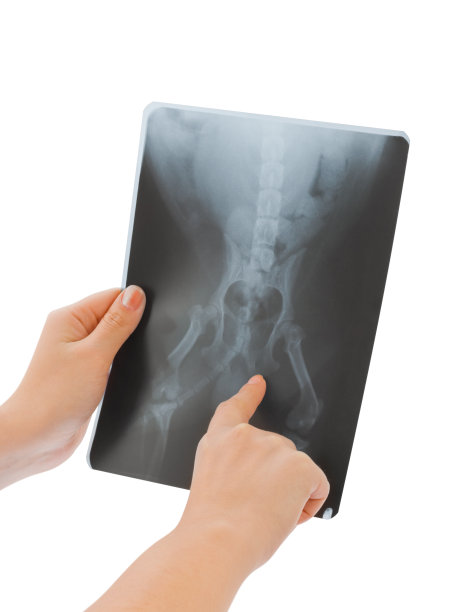 x射线在手中图片下载