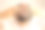 脱发照片素材ID：120522838