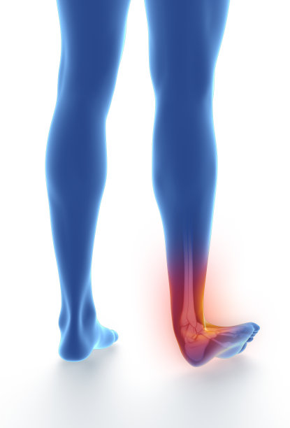 踝关节扭伤，白色上发青孤立图片下载