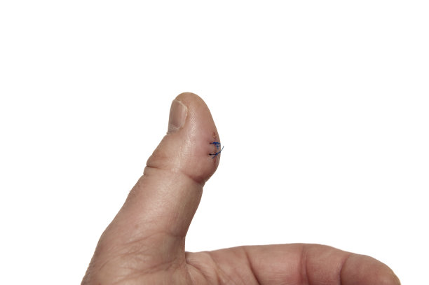 拇指上的伤口-拇指向上-白色背景图片下载