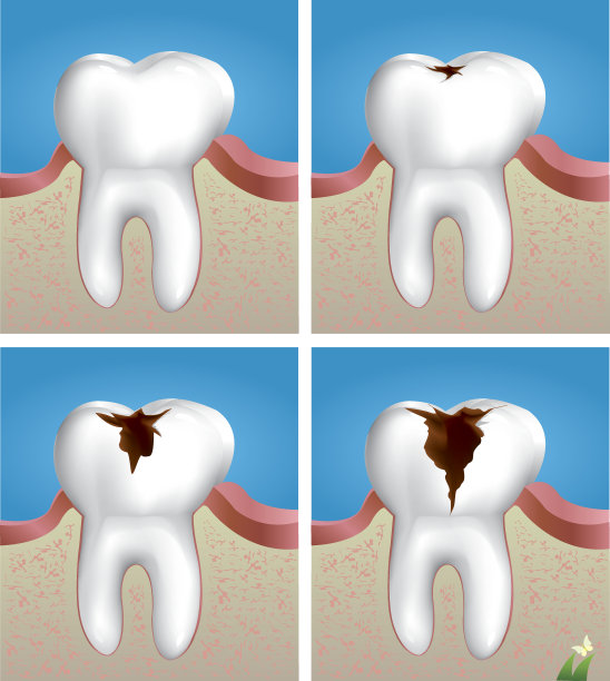 蛀牙图片下载