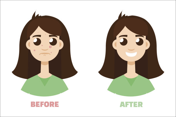 痤疮女孩之前和之后。平的风格图片下载