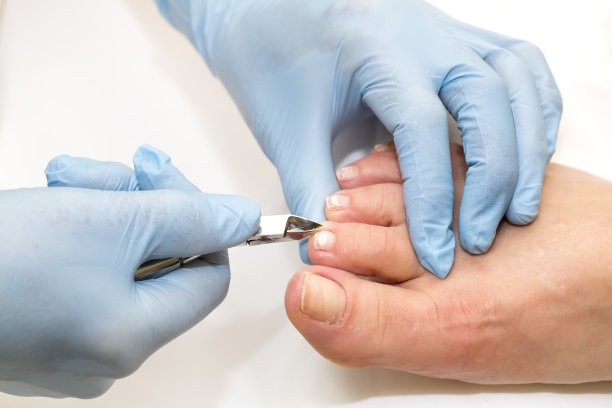 修脚的过程图片下载