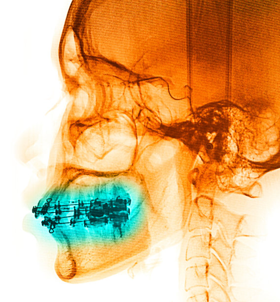 x射线扫描人类图片下载