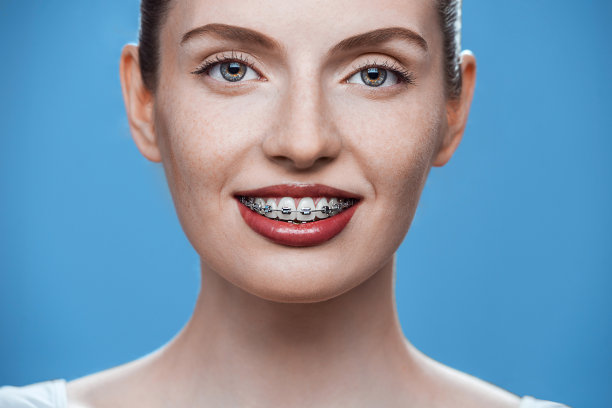 快乐漂亮的女孩戴着牙套图片下载